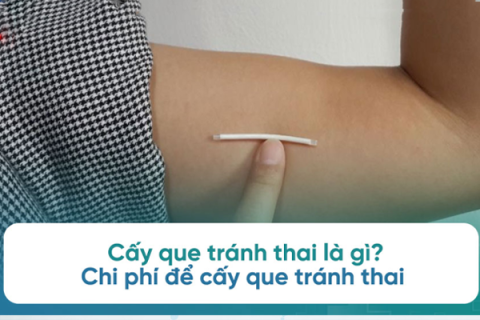 cay-que-tranh-thai-bao-nhieu-tien