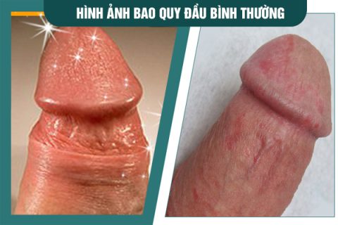 hinh-anh-bqd-binh-thuong